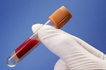 乙肝全身表現有哪些癥狀？