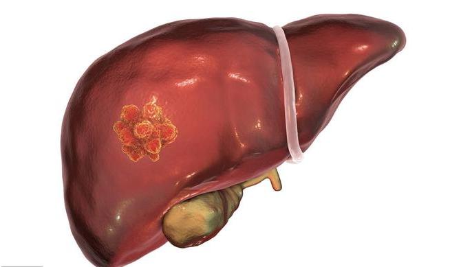 乙肝如何預防與科學治療